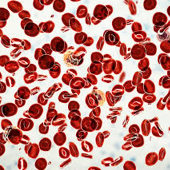 JAK2 Mutation Detection Qualitative PCR
